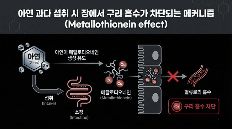 아연 과다복용 시 나타나는 구리 결핍과 메스꺼움 증상을 보여주는 인포그래픽